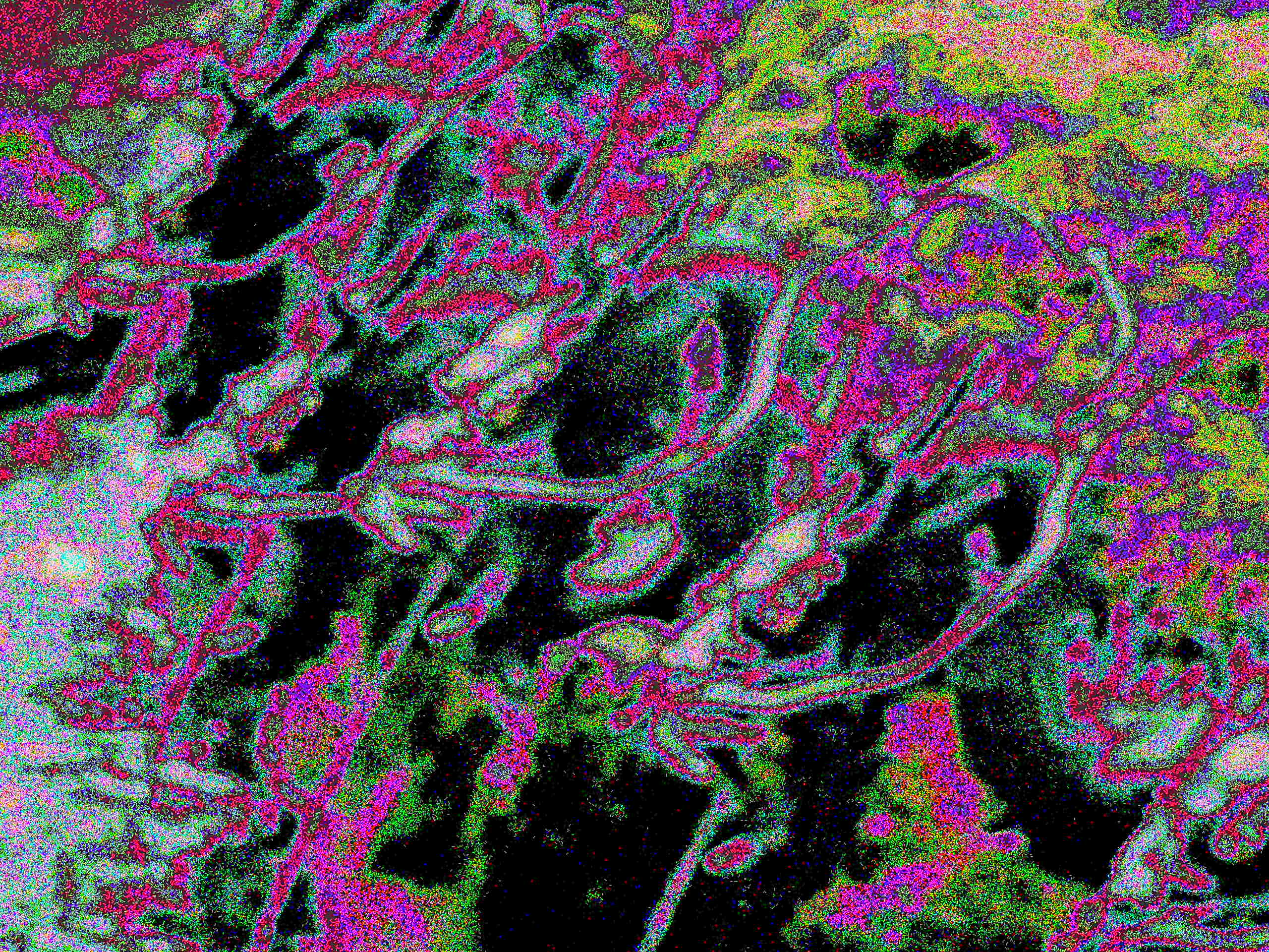 Glitch Photography | Thomas Bjave Price | Day 370 P1420376 | Fascination