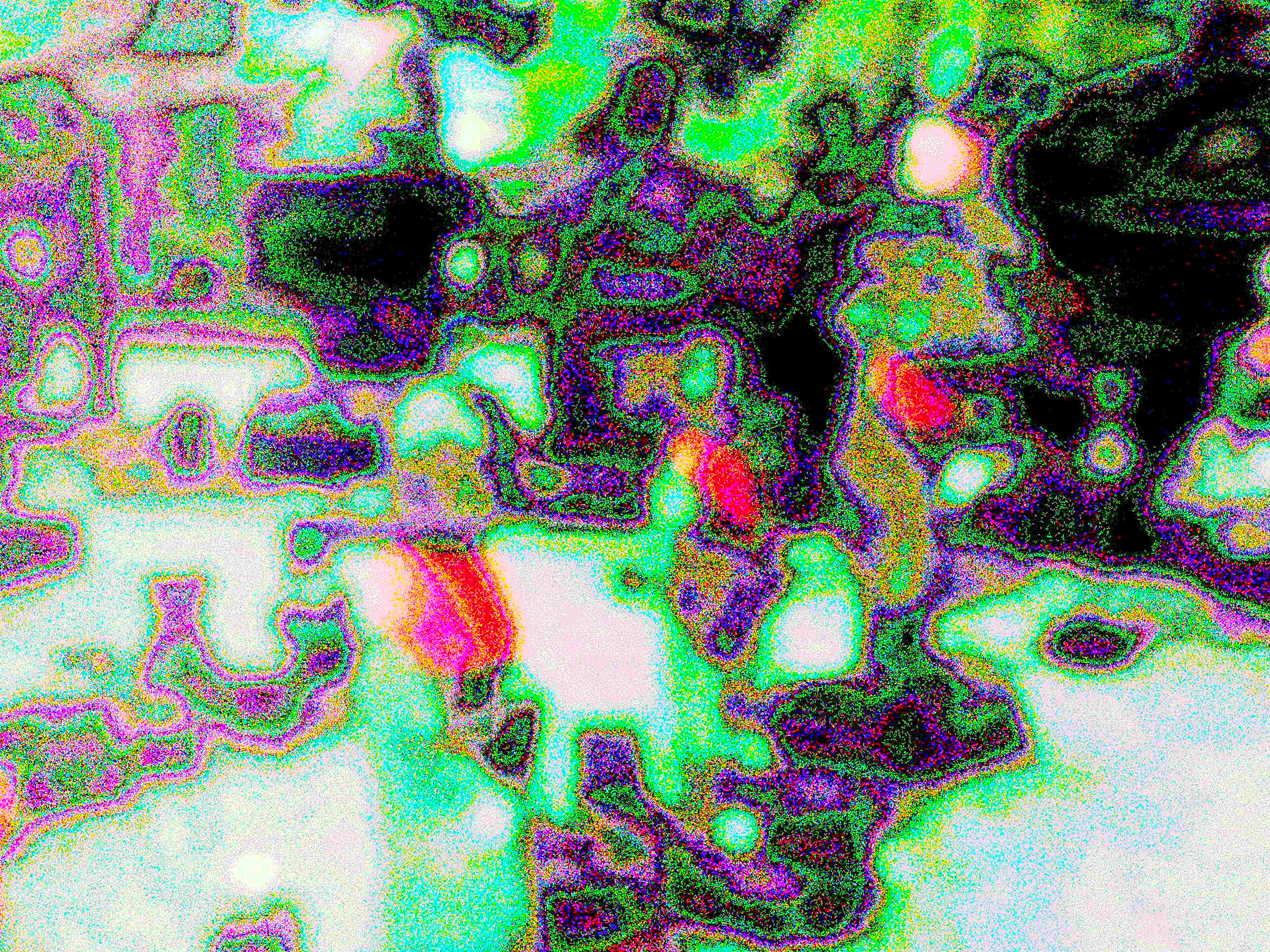 Glitch Photography | Thomas Bjave Price | Day 377 P1420411  | Lead and Follow