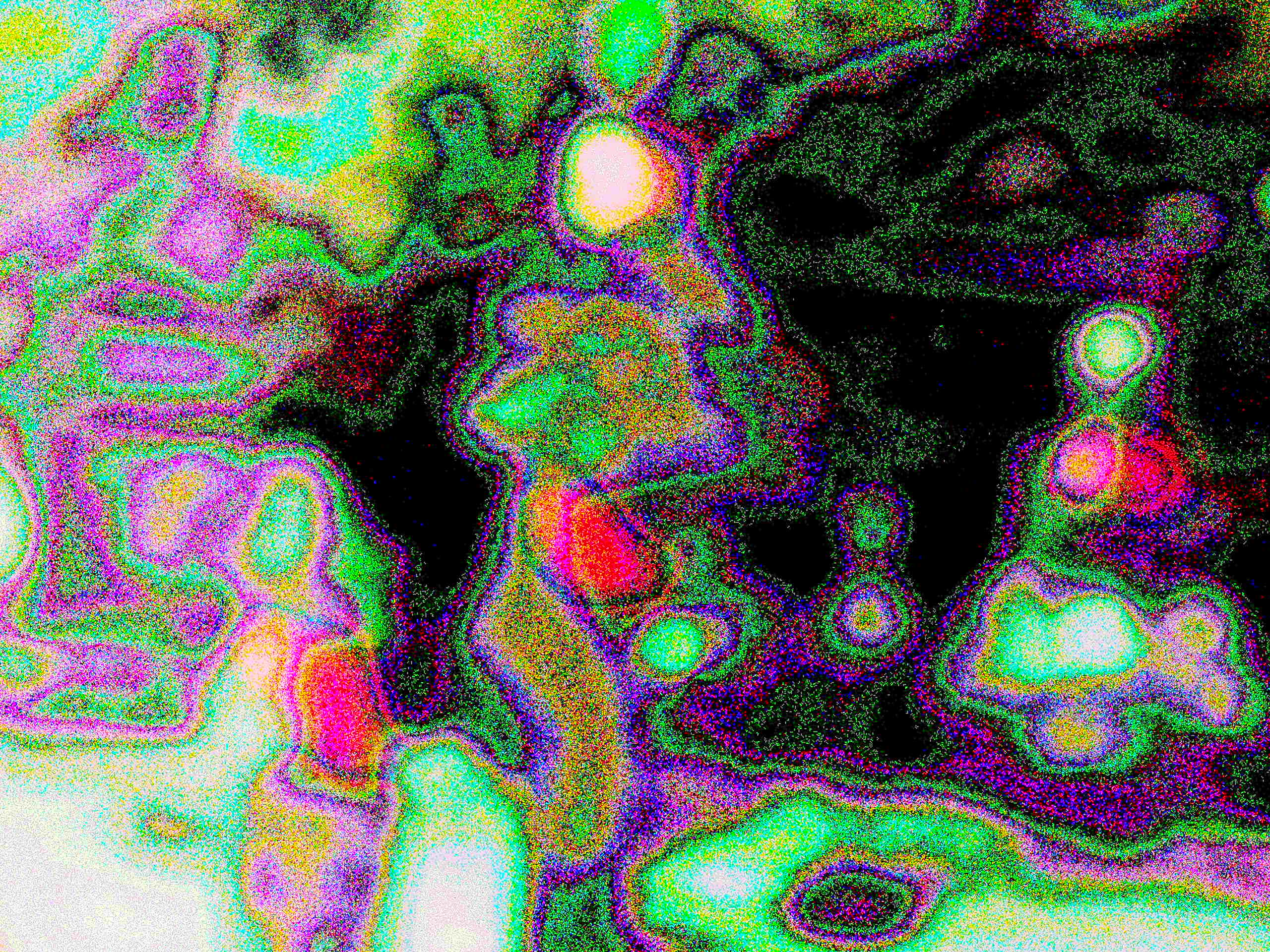 Glitch Photography | Thomas Bjave Price | Day 378 P1420412 | Fuzzy Logic