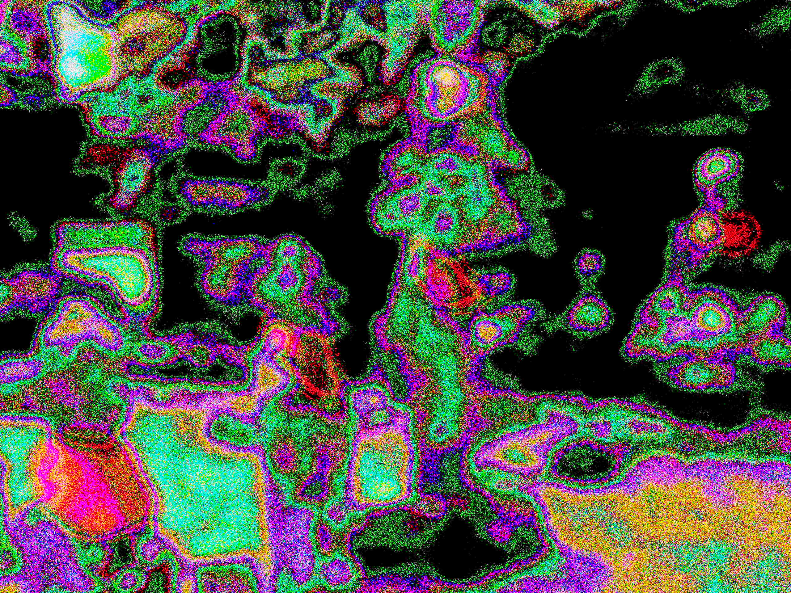 Glitch Photography | Thomas Bjave Price | Day 379 P1420414 | Queen to Bishop 6, Check